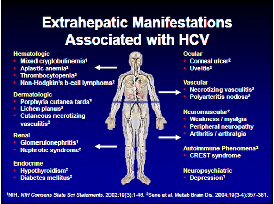 Extra-hepatic manifestations of Hepatitis C