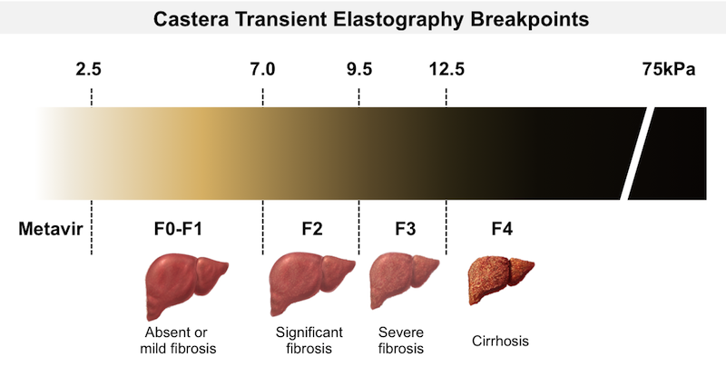 correlation-breakpoints-metavir-fibrosis-scores.jpg